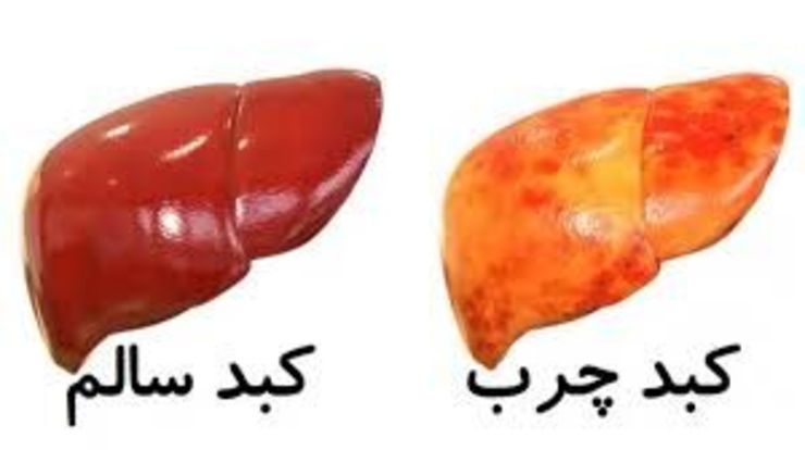 رئیس مرکز تحقیقات بیماری‌های گوارش و کبد دانشگاه علوم پزشکی بقیة الله (عج) به رشد کبد چرب در کشور اشاره کرد و گفت: طی ۲۰ سال اخیر کبد چرب در کشور حداقل ۲ برابر شده که این موضوع نگران‌کننده است.