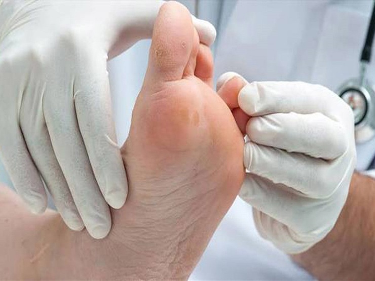 شرکت بنبوتون با استفاده از فناوری نانو کفی هوشمندی طراحی کرده است که می‌تواند در صورت مشاهده امکان ایجاد التهاب موضعی، صاحب آن را از طریق تلفن هوشمند مطلع کند.