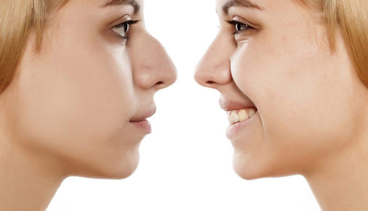 برای سنین قبل از ۱۸ سال، انجام جراحی بینی برای فرد توصیه نمی‌شود.