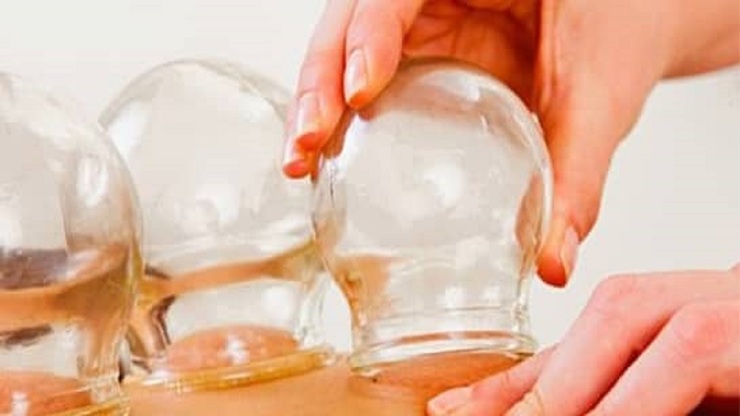 صحبت‌های مطرح شده در خصوص نقش حجامت در پیشگیری از ابتلا به ویروس کرونا و درمان این بیماری تأیید شده نیست.
