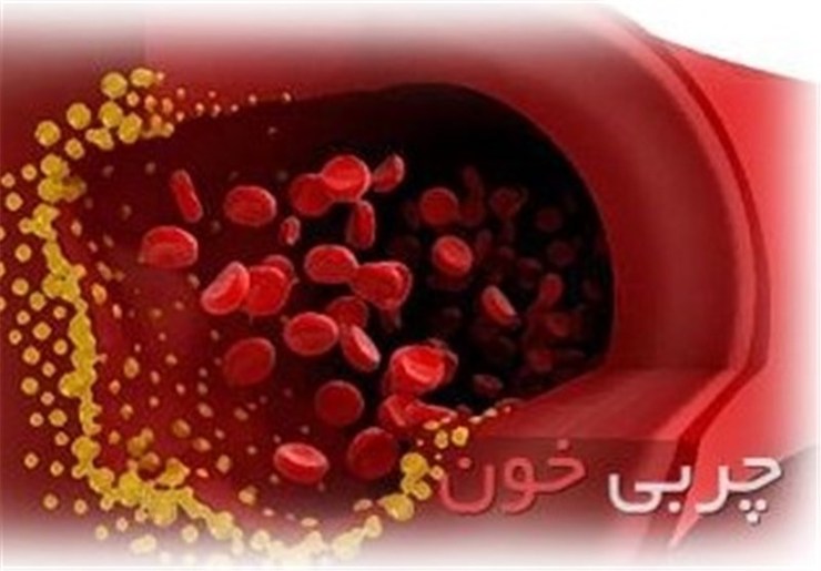 ۷۰ درصد مردم خراسان رضوی در گروه‌های خاص چربی خون بد دارند، این در حالی است که ۵۰ درصد مردم ایران سطح کلسترول خون نرمال و پایینی دارند.