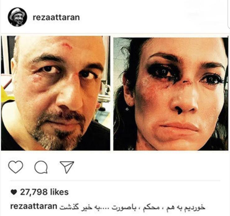 رضا عطاران بازیگر سینما و تلویزیون عکسی از صورت زخمی خود را در اینستاگرام شخصی‌اش منتشر کرد.