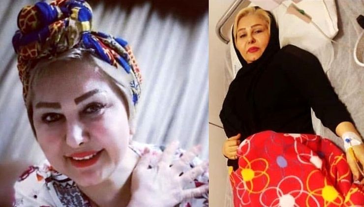 زیبا مهرعلیزاده بازیگر شیرازی در سن ۶۰ سالگی به علت ابتلا به سرطان درگذشت.