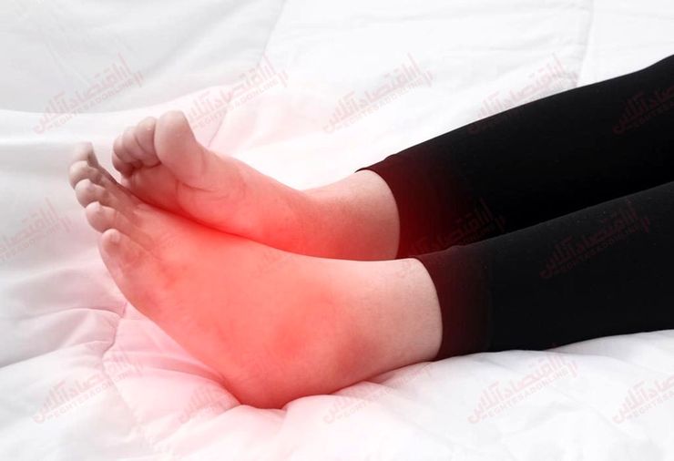 تورم در پا‌ها و مچ پا، ادم نامیده می‌شود و موارد زیادی وجود دارد از فشار خون بالا گرفته تا بارداری، که می‌تواند این مشکل را ایجاد کند. آن چه در بدن شما اتفاق می‌افتد مشکل در غلبه بر گرانش است برای این که خون و مایعات را از پا‌ها بازگرداند، بنابراین روی پا، مچ پا و حتی بالای پا‌ها ممکن است متورم شود.