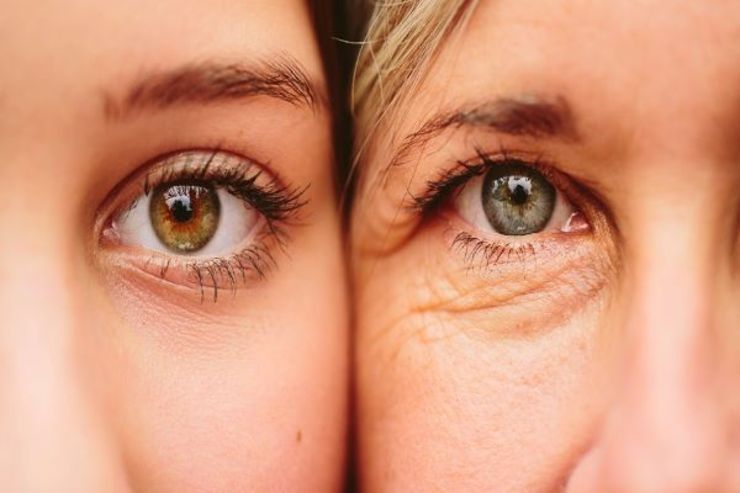 با افزایش سن، چین و چروک‌ها و لک‌های پوستی بیشتر می‌شوند. این مسئله، بخشی از چرخه‌ی طبیعی زندگی است. اگر این تغییرات زودتر از زمان موعد بروز یابند، طبیعی نیستند. به همین دلیل به آن پیری زودرس پوست می‌گویند.