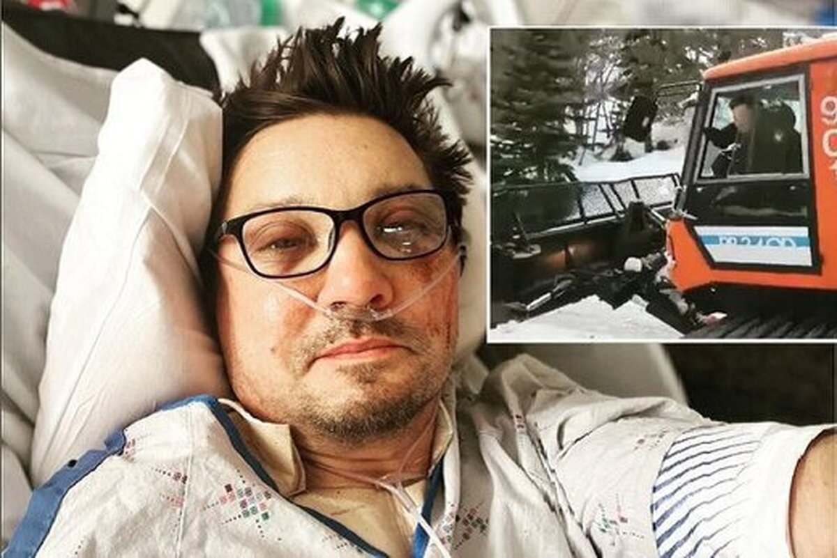 جرمی رنر بازیگر فیلم‌ «انتقام‌جویان» و مجموعه «ماموریت غیرممکن» گفت: در روز سال نو بیش از ۳۰ استخوانم در یک تصادف برف روب شکسته است.
