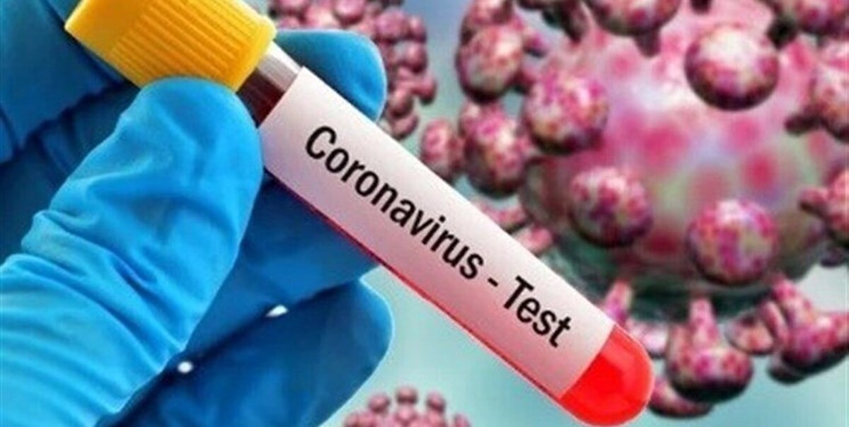 رییس کمیته رسانه و اطلاع‌رسانی قرارگاه مدیریت کرونا در دانشگاه علوم پزشکی مشهد گفت: در شبانه روز گذشته ۴۴ بیمارجدید مبتلا و یا مشکوک به کرونا در مراکز درمانی زیر پوشش این دانشگاه بستری شدند.