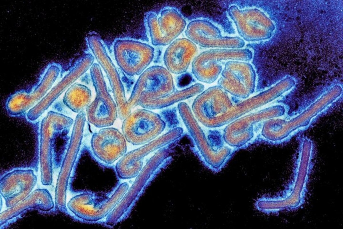 بیماری ویروسی ماربورگ (Marburg Virus)، یک بیماری سخت و اغلب کشنده در انسان است. این ویروس با تب خونریزی دهنده شدید همراه است.