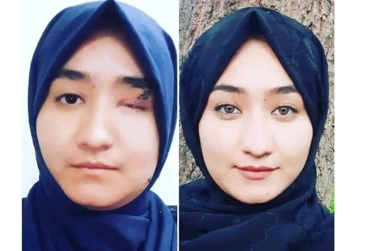 فاطمه امیری، یکی از زخمیان حمله داعش بر آموزشگاه کاج در کابل خطاب به دختران افغانستان می‌گوید: تسلیم نشوید.