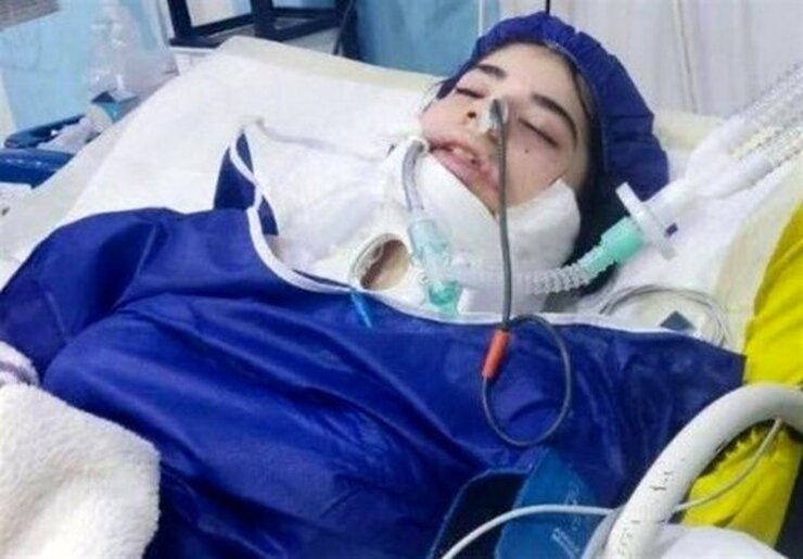 پدر آرنیکا قائم مقامی درباره نحوه فوت دخترش گفت: دخترم به خاطر حادثه سقوط جان باخته است.