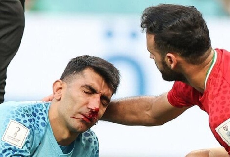 علیرضا بیرانوند، گلر تیم ملی در بازی با انگلیس مصدوم شد و حالا حضورش در بازی با ولز و آمریکا در هاله ای از ابهام است.