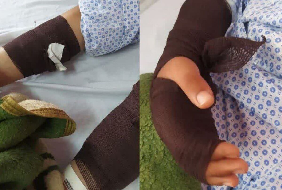 سگی در چناران پس از گازگرفتن ۴ نفر، تلف شد.