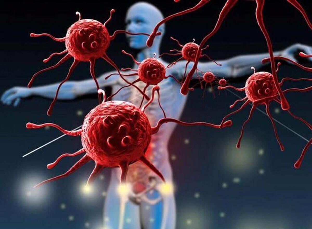 یک متخصص ایمونولوژی از افزایش احتمال خطر ابتلا به بیماریهای خودایمنی در مبتلایان به فرم شدید کرونا خبر داد.