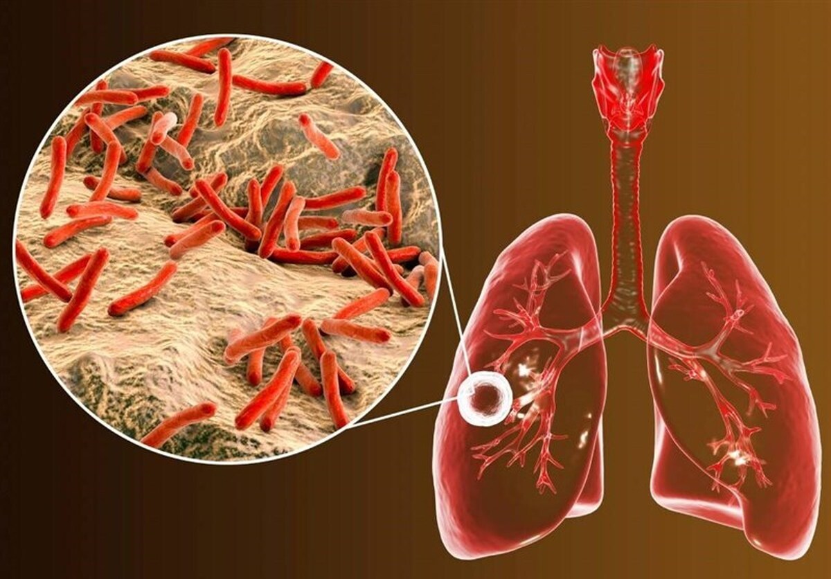 رئیس گروه پیشگیری دانشگاه علوم پزشکی مشهد گفت: در سال گذشته ۵۶۳ بیمار مبتلا به سل در محدوده دانشگاه علوم پزشکی مشهد شناسایی شد.