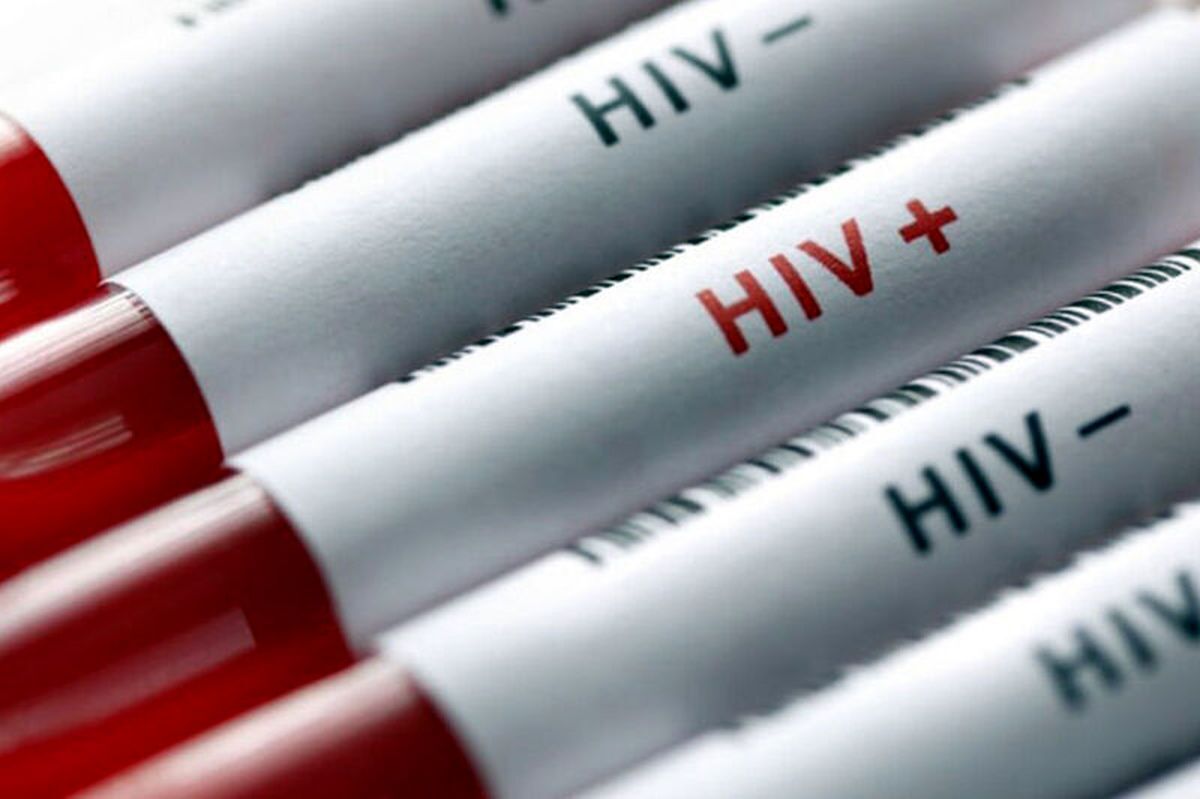 محققان با کمک siRNA نانودارویی ساختند که می‌تواند تکثیر ویروس HIV را ۷۳ درصد کاهش دهد.