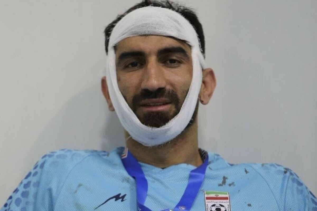 دروازه بان تیم ملی مورد عمل جراحی قرار گرفت.