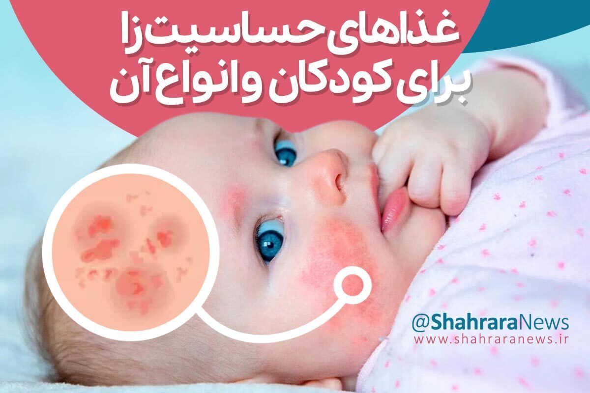 یکی از مشکلات تغذیه در کودکان شیرخوار که با شروع خوردن مواد غذایی کمکی به وجود می‌آید آلرژی است که در مورد تمام کودکان نیز اتفاق نمی‌افتد یا در برخی می‌تواند شدیدتر و در برخی خفیف‌تر باشد.