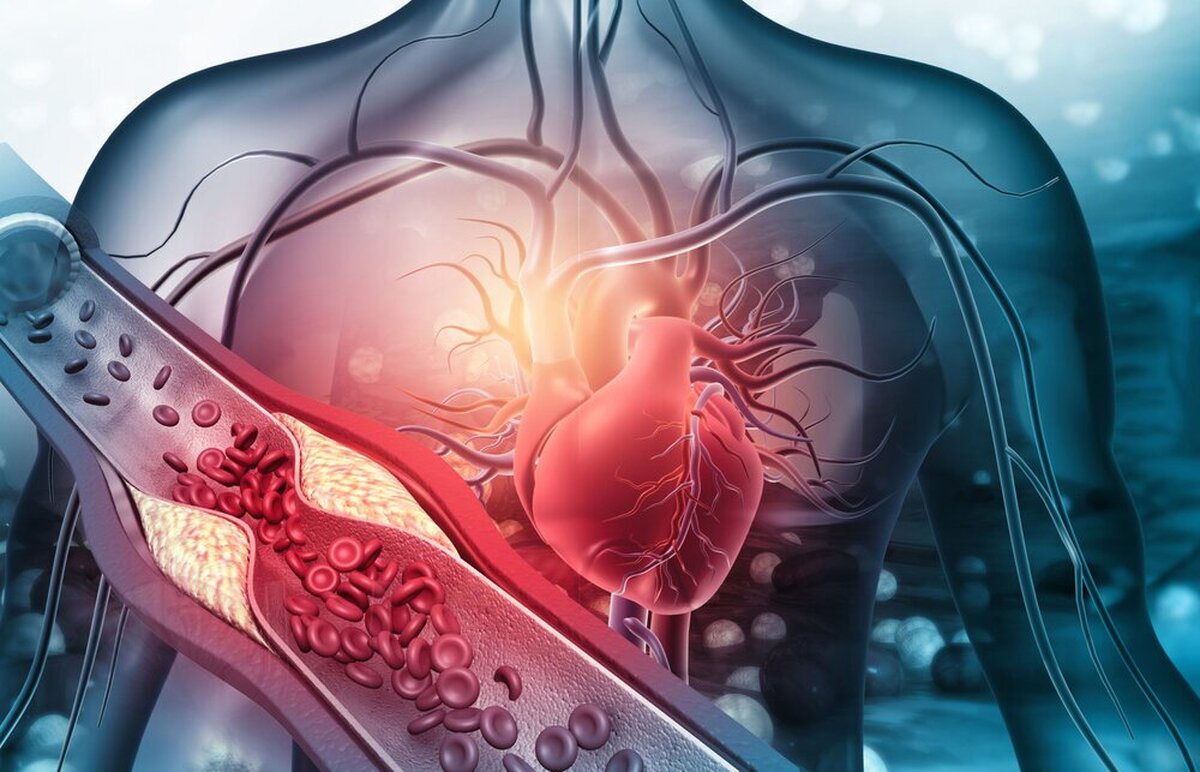 یک فوق تخصص جراحی عروق معتقد است رسیدگی دائم به عروق و پایش مکرر قند خون افراد دیابتی، کمک موثری در جلوگیری از تشدید بیماری‌های قلبی و عروقی محسوب می‌شود.