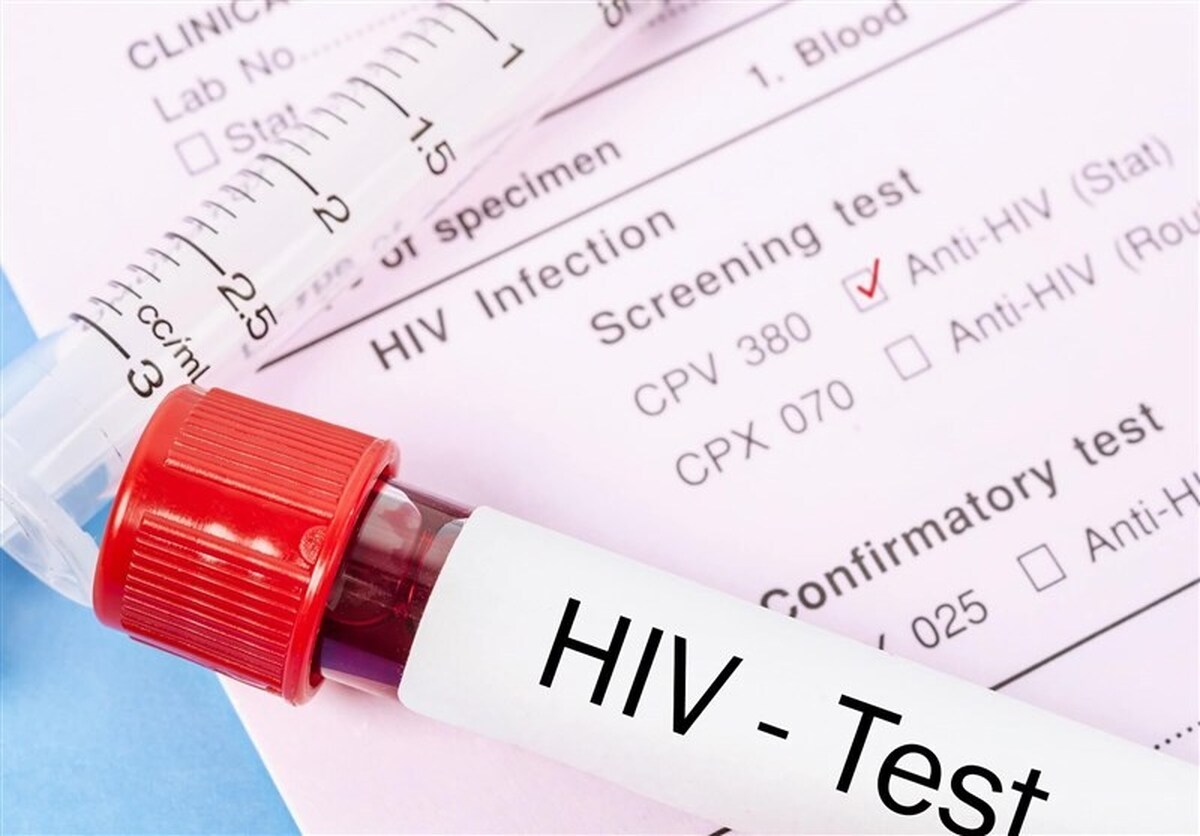 رئیس اداره کنترل ایدز وزارت بهداشت با اشاره به تغییر الگوی انتقال ویروس HIV، گفت: اگرچه درمان قطعی برای HIV وجود ندارد، اما دارو‌های موجود توان این را دارند تا میزان ویروس در خون را به صفر برسانند.