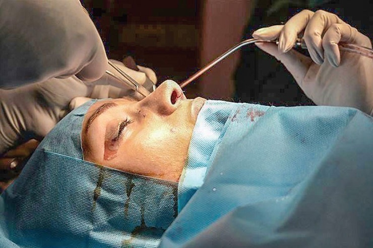 صنعت پزشکی زیبایی و جراحی‌های مربوط به آن به یک صنعت چند میلیارد دلاری تبدیل شده است. تقریباً در تمام کشورهای دنیا این مسئله دیگر عادی شده است ولی به چه قیمتی؟