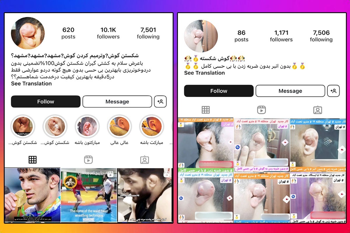 پس از بازی حسن یزدانی در المپیک پاریس، تبلیغات شکستن گوش در فضای مجازی دست به دست می‌چرخد.