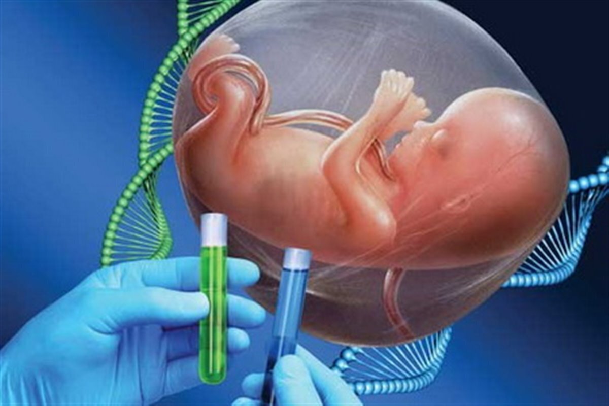 استاد گروه ژنتیک دانشگاه علوم پزشکی مشهد گفت: از دلایل مهم شیوع برخی بیماری‌های ژنتیکی در کشور، بالابودن میزان ازدواج‌های فامیلی در مناطقی از کشور است و همینطور وجود برخی فرهنگ‌ها که سقط جنینِ دارای ناهنجاری‌های ژنتیکی را علیرغم وجود حکم شرعی آن نمی‌پذیرند.