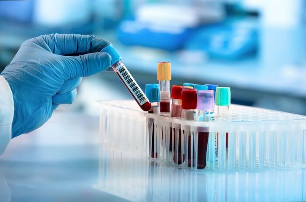 مسئول پیشگیری از ایدز و هپاتیت دانشگاه علوم پزشکی مشهد گفت: در حال حاضر، نسبت ابتلا به ایدز در مناطق زیر پوشش این دانشگاه در بین زنان و مردان مساوی است؛ درحالی‌که این نسبت در گذشته، ۸۰ درصد مردان و ۲۰ درصد زنان بود.