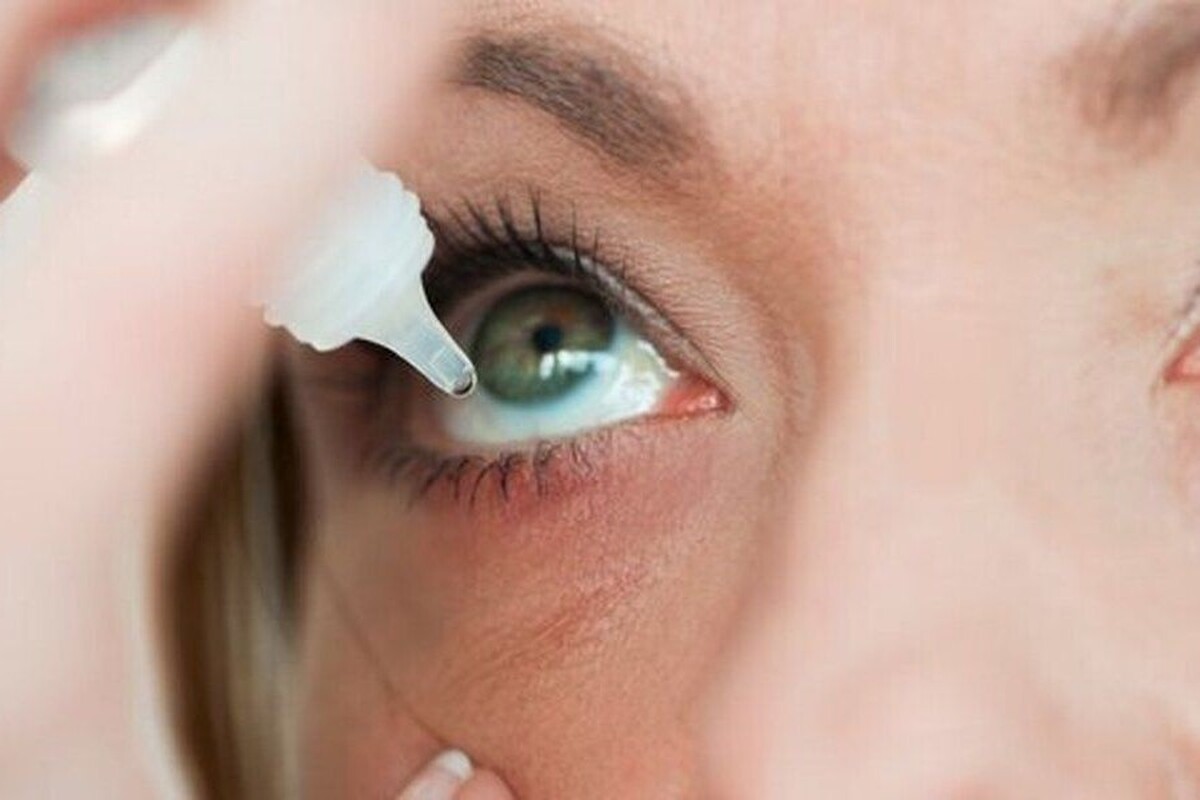 سندروم شوگرن (Sjogren’s Syndrome) یک اختلال خودایمنی رایج در سطح جهانی است که در میان زنان شیوع بیشتری دارد.