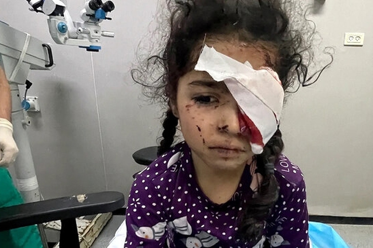 تاکنون ۱۵۰۰ فلسطینی در جنگ غزه بینایی خود را از دست داده‌اند